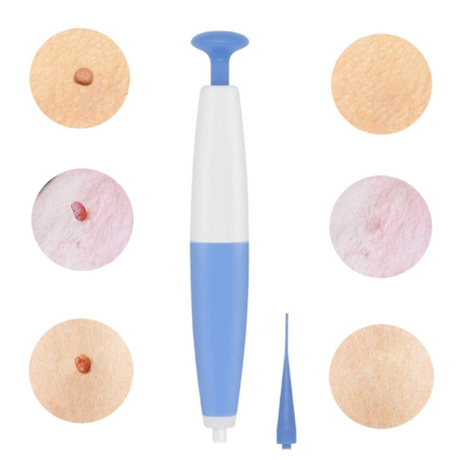 Skin Tag Remover Kit — Painless 3mm Home Use Device 5