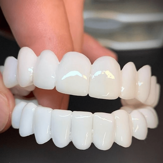 SmileFlex - Lichtgewicht en aanpasbare tandprothese met natuurlijke uitstraling