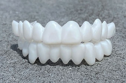 SmileFlex - Protesi Dentale Leggera e Personalizzabile con Aspetto Naturale