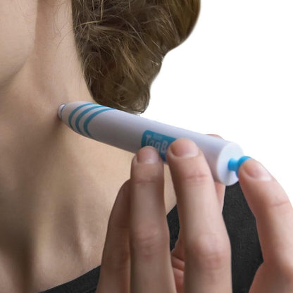 Skin Tag Remover Kit — Painless 3mm Home Use Device 2